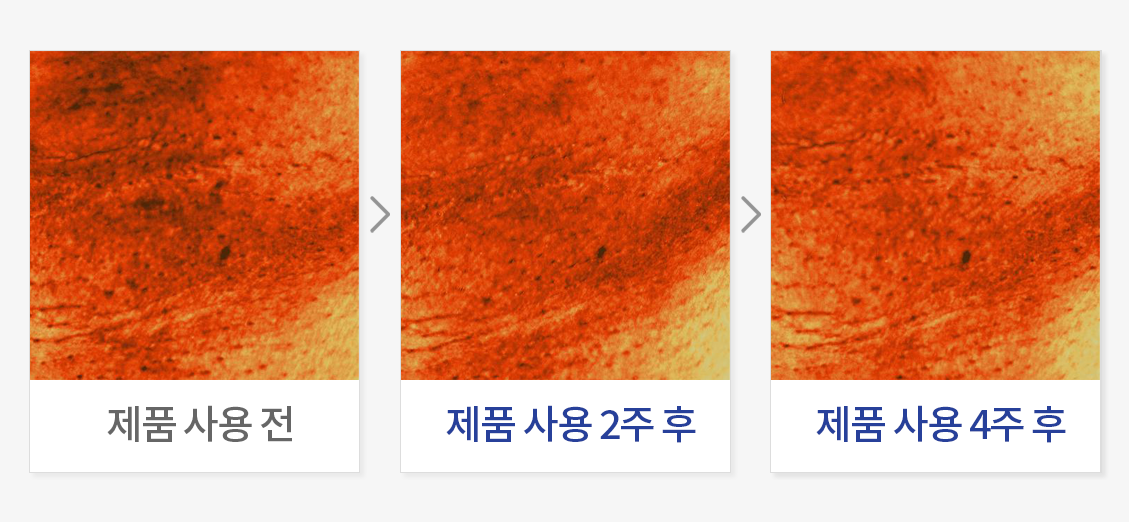 피부 멜라닌 개선 (겨드랑이)