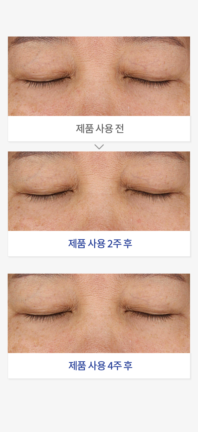 다크서클 완화 평가