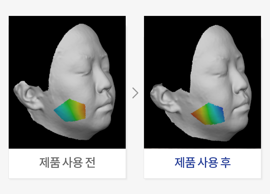 붓기 완화 평가