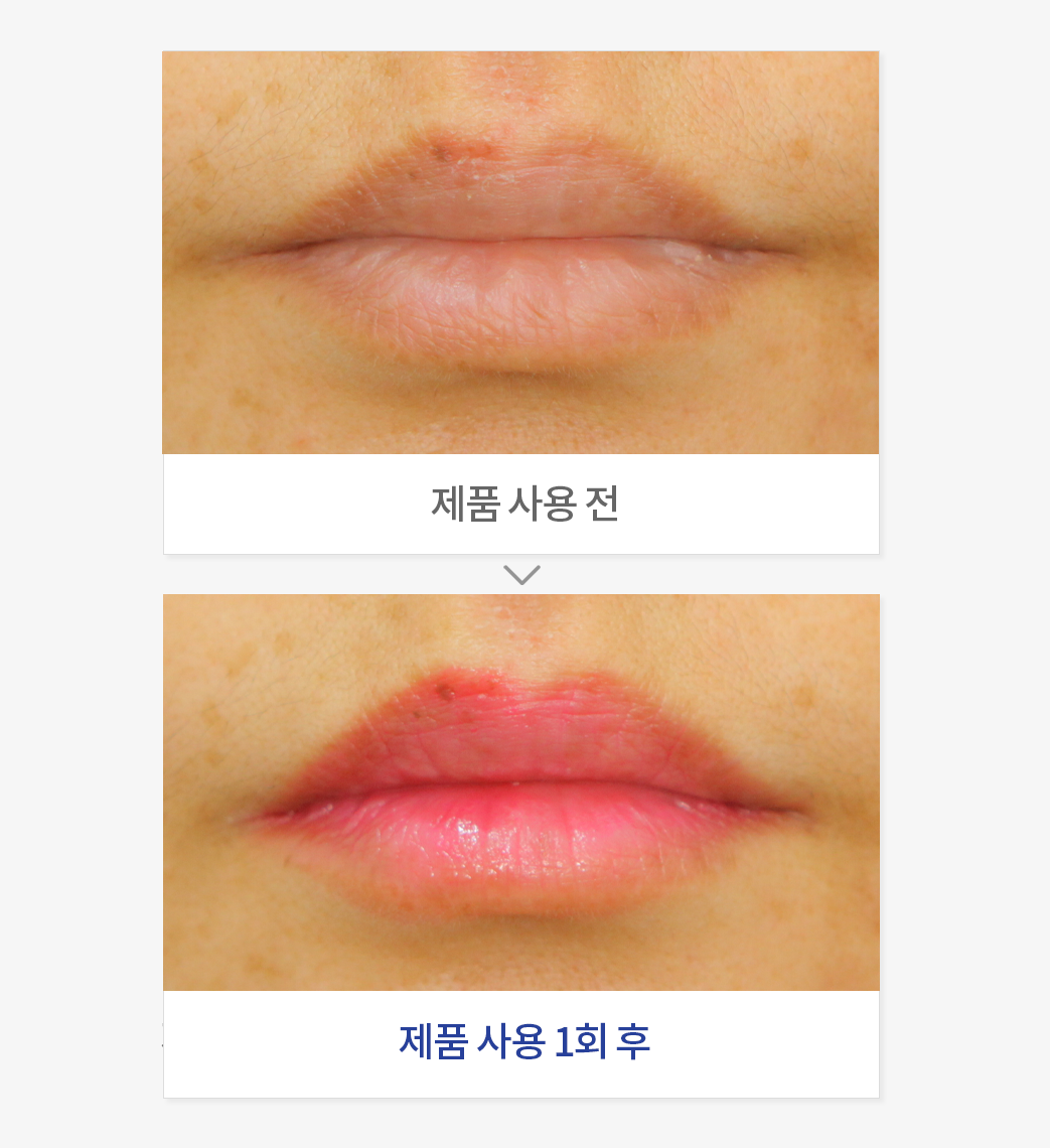입술 착색도 개선