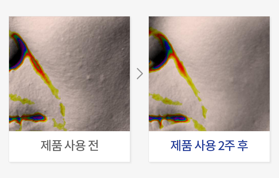 주름 깊이 개선
