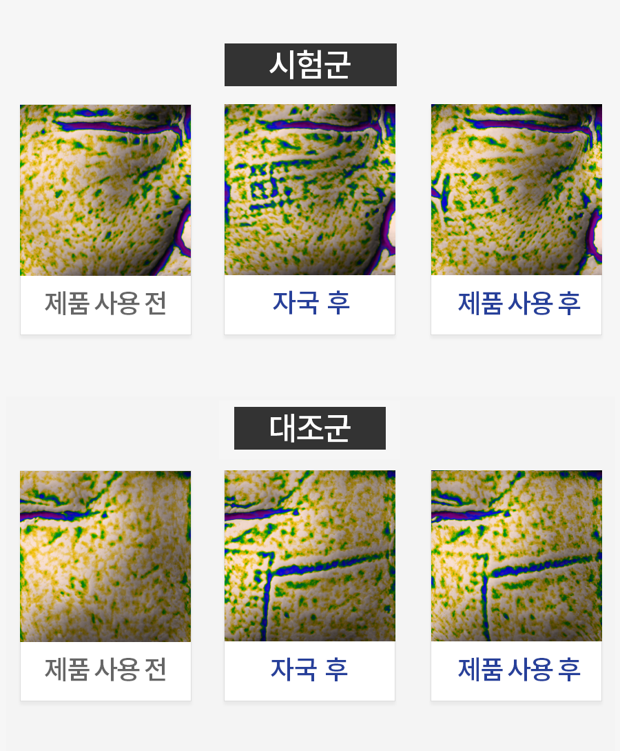 마스크 줄 자국 개선 평가