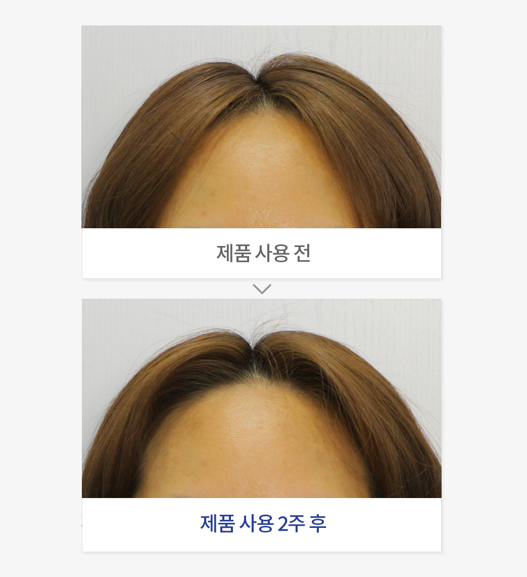 모발 볼륨 개선