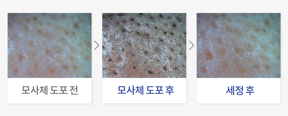 모공 속 노폐물 세정력 평가