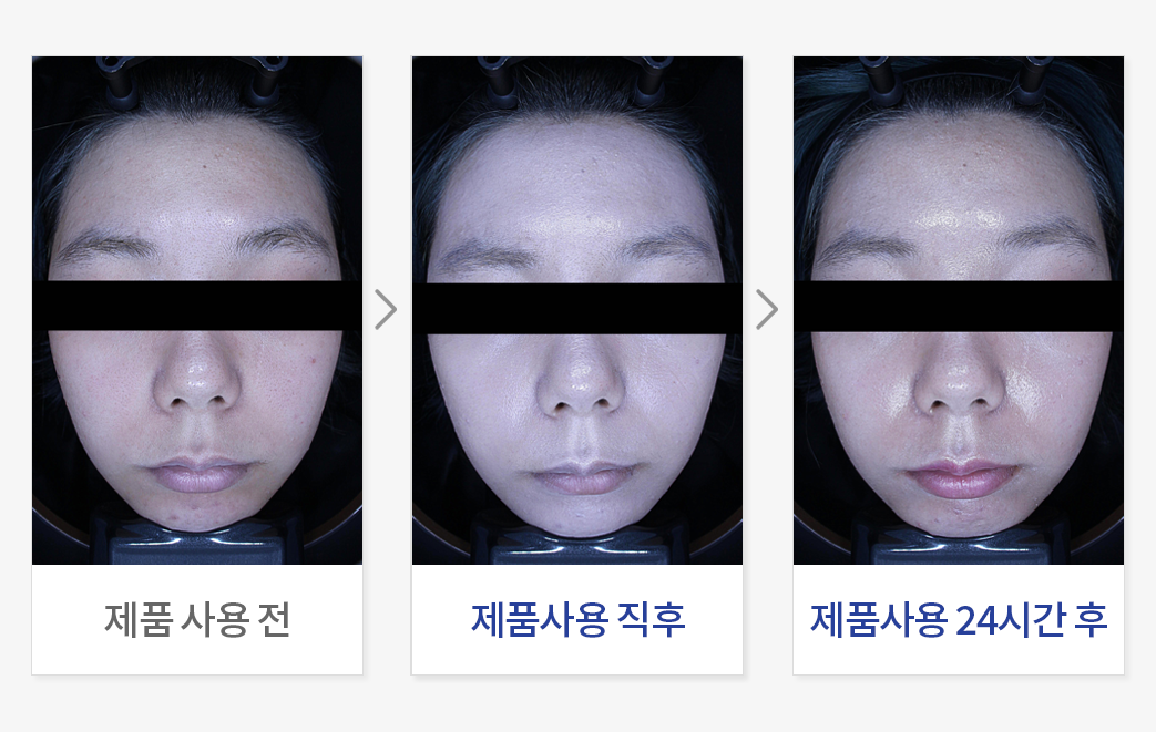 N시간 피부 윤기(광채) 개선