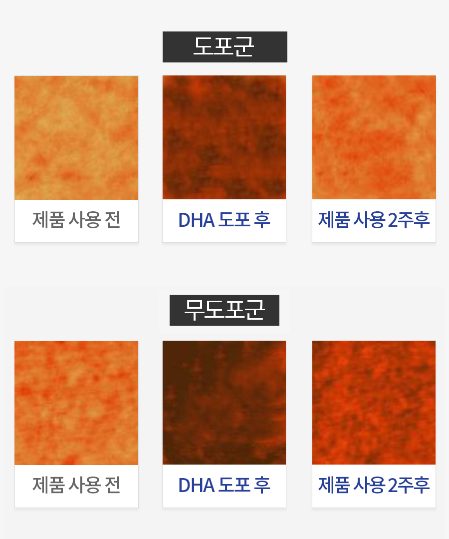 턴오버 개선