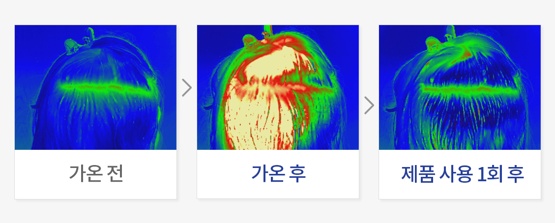 외부자극(열감)에 의한 두피 진정