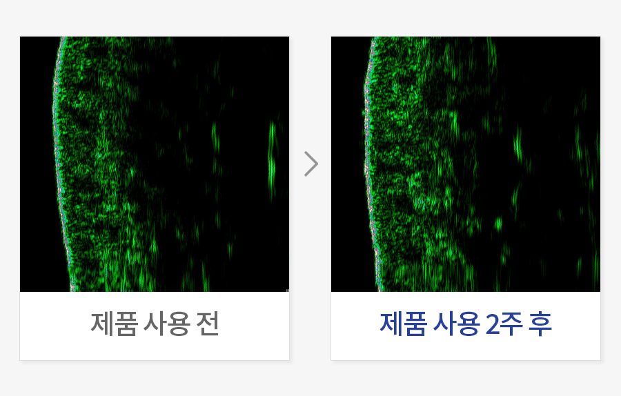 피부 치밀도 개선