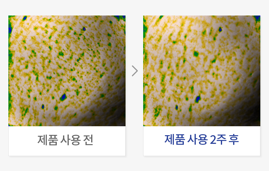 피부 볼륨 개선