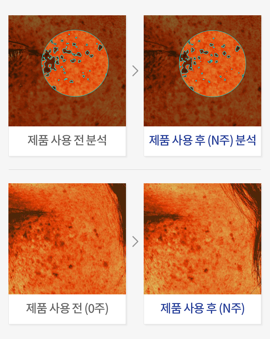 피부 겉 기미 개선