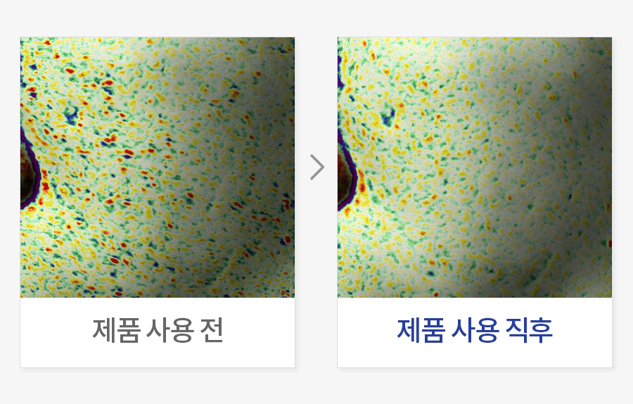 피부결 개선