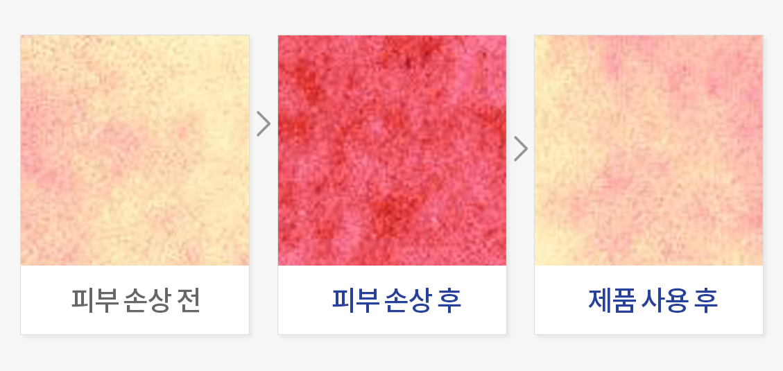 피부 진정(물리적 자극)