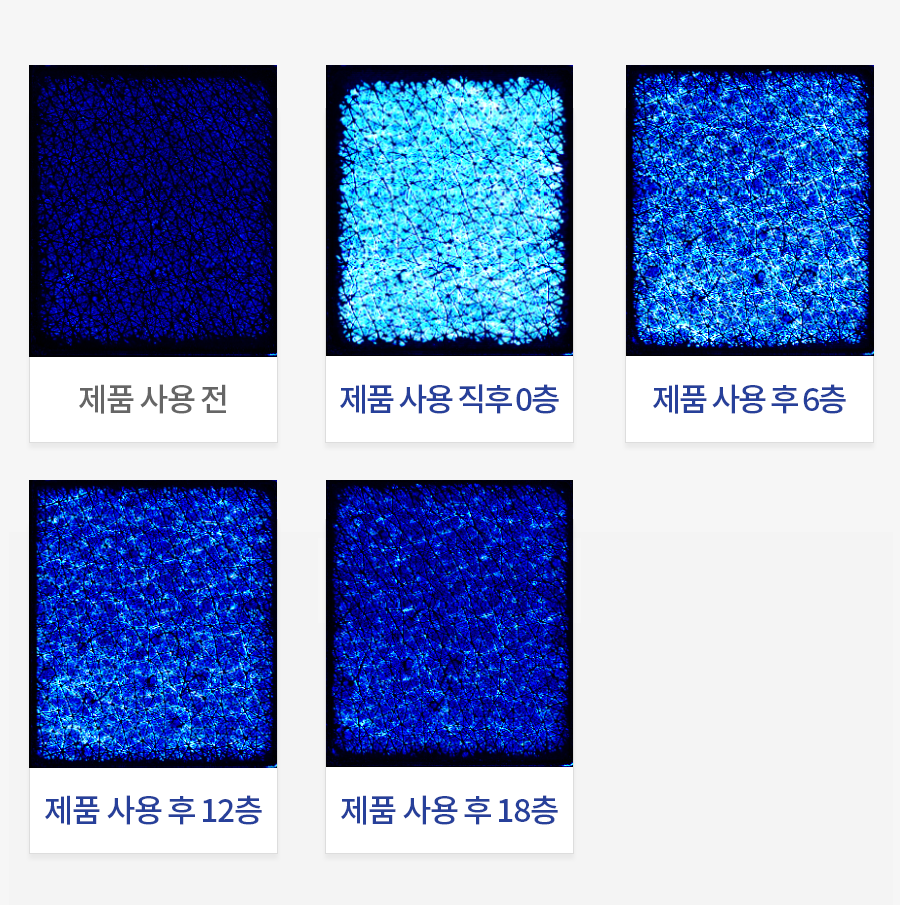 피부 N층 보습 개선