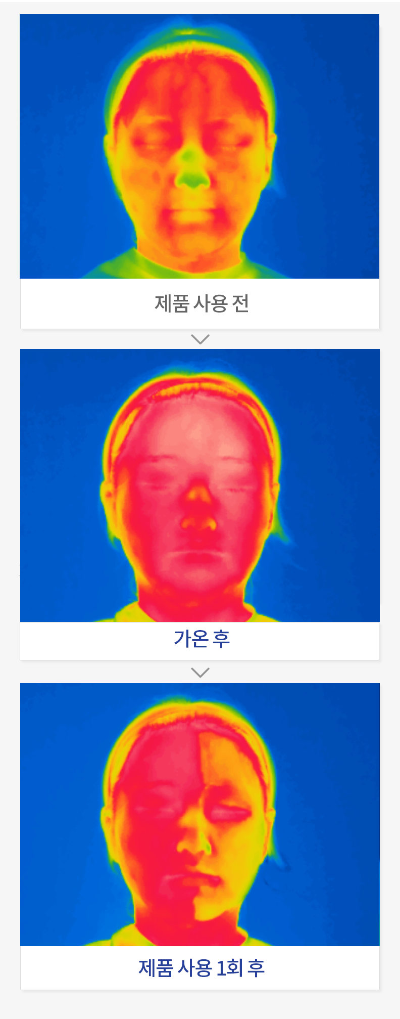피부 온도 감소