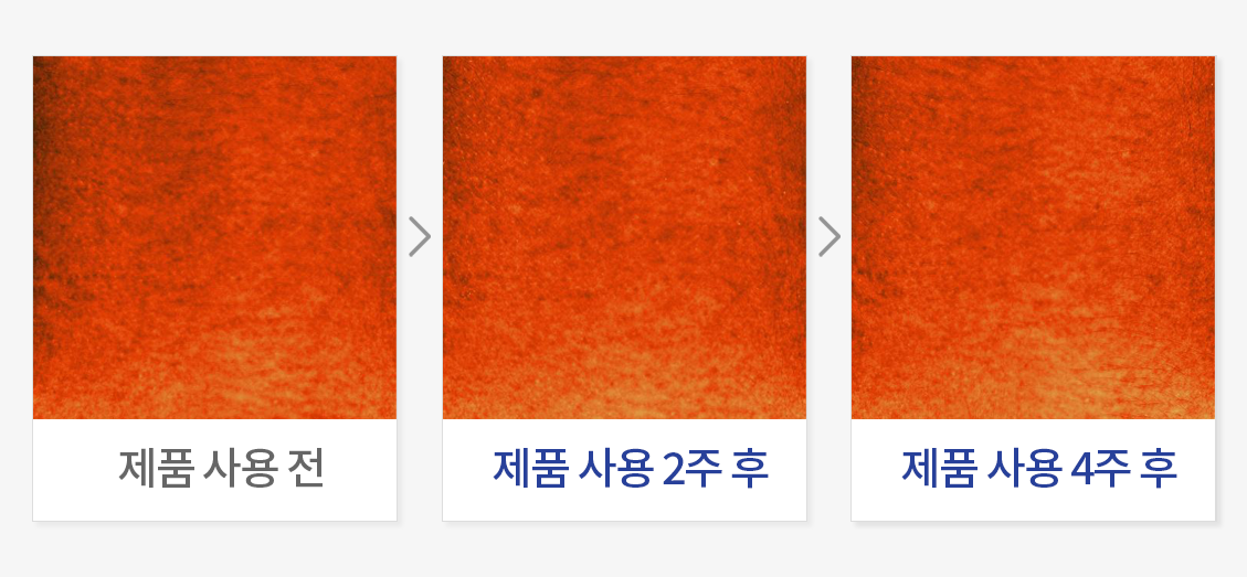 피부 멜라닌 개선 (뒷목)