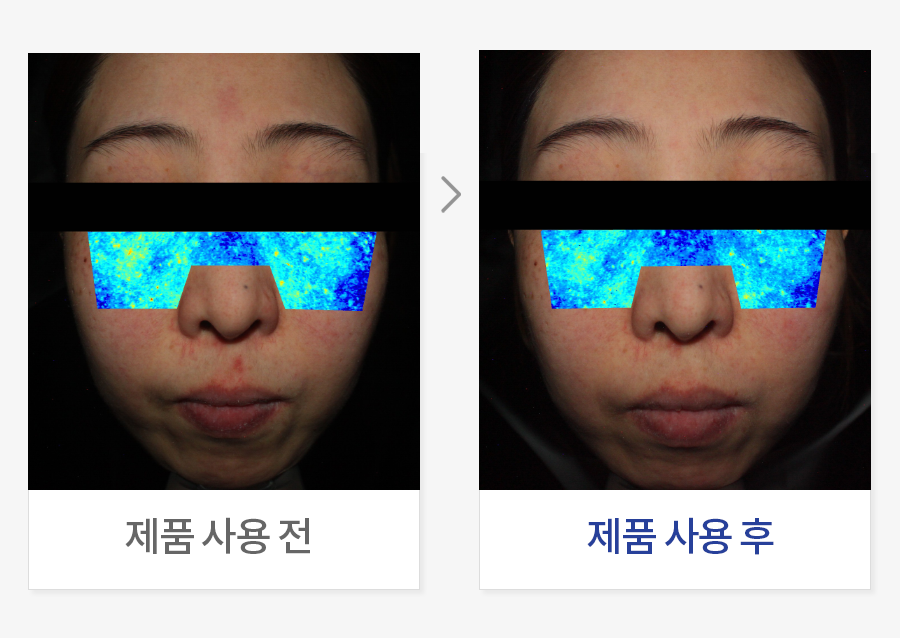 피부 멜라닌 커버력 평가