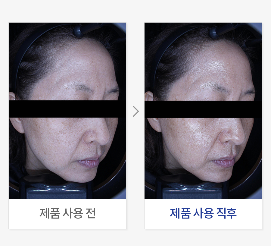 피부 윤기(광채) 개선
