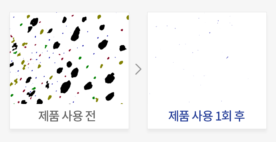 피지(유분) 개선