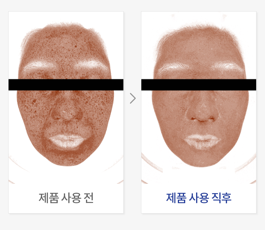 색소침착 커버력 평가