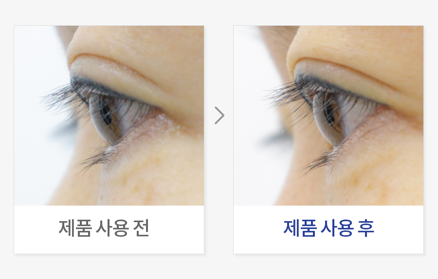 속눈썹 컬링 개선