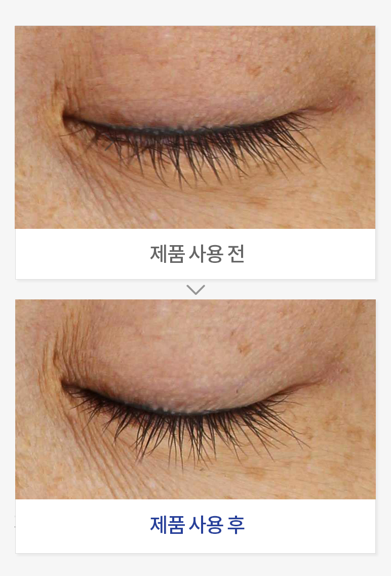 속눈썹 볼륨 개선