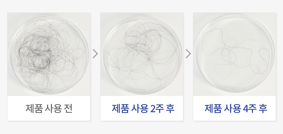 탈락모발 수 개선