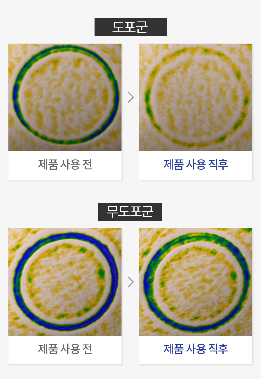 탄성 복원력 평가